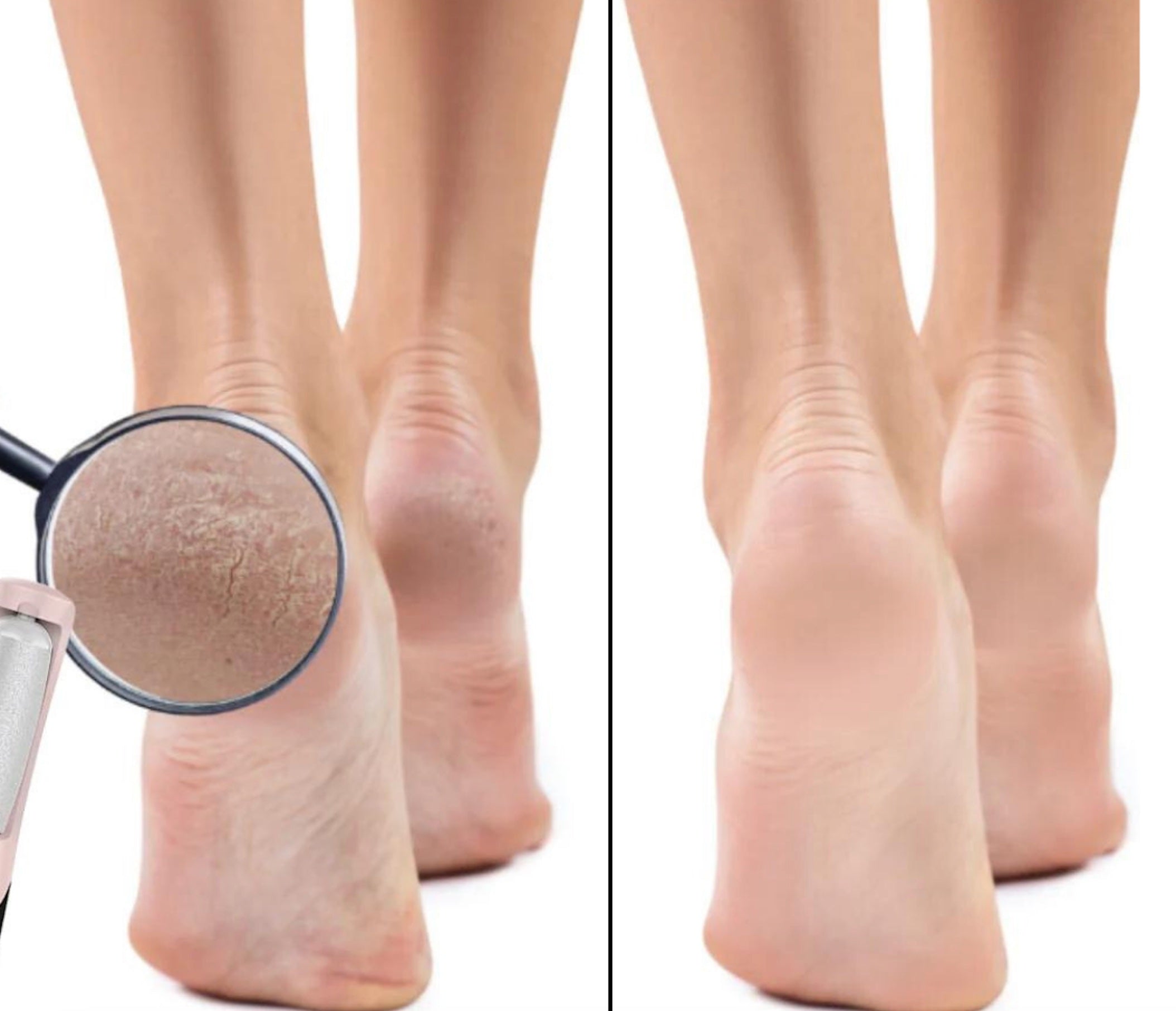 Strahlende Füße™ - Ihr Fußpflege-Buddy