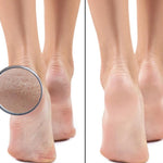 Strahlende Füße™ - Ihr Fußpflege-Buddy